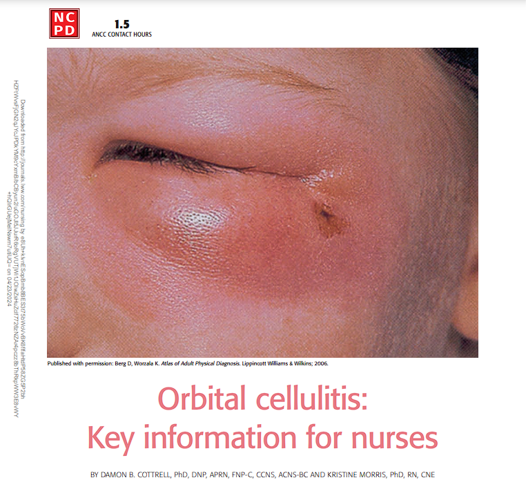 🩺✨ Ready for an enriching read and NCPD credits? Explore the interdisciplinary care needs of patients with Orbital Cellulitis in our insightful article from our May 2024 issue. 📖 

ow.ly/RFI650RsRrT

#NurseEducation #OrbitalCellulitis #HealthcareInsights