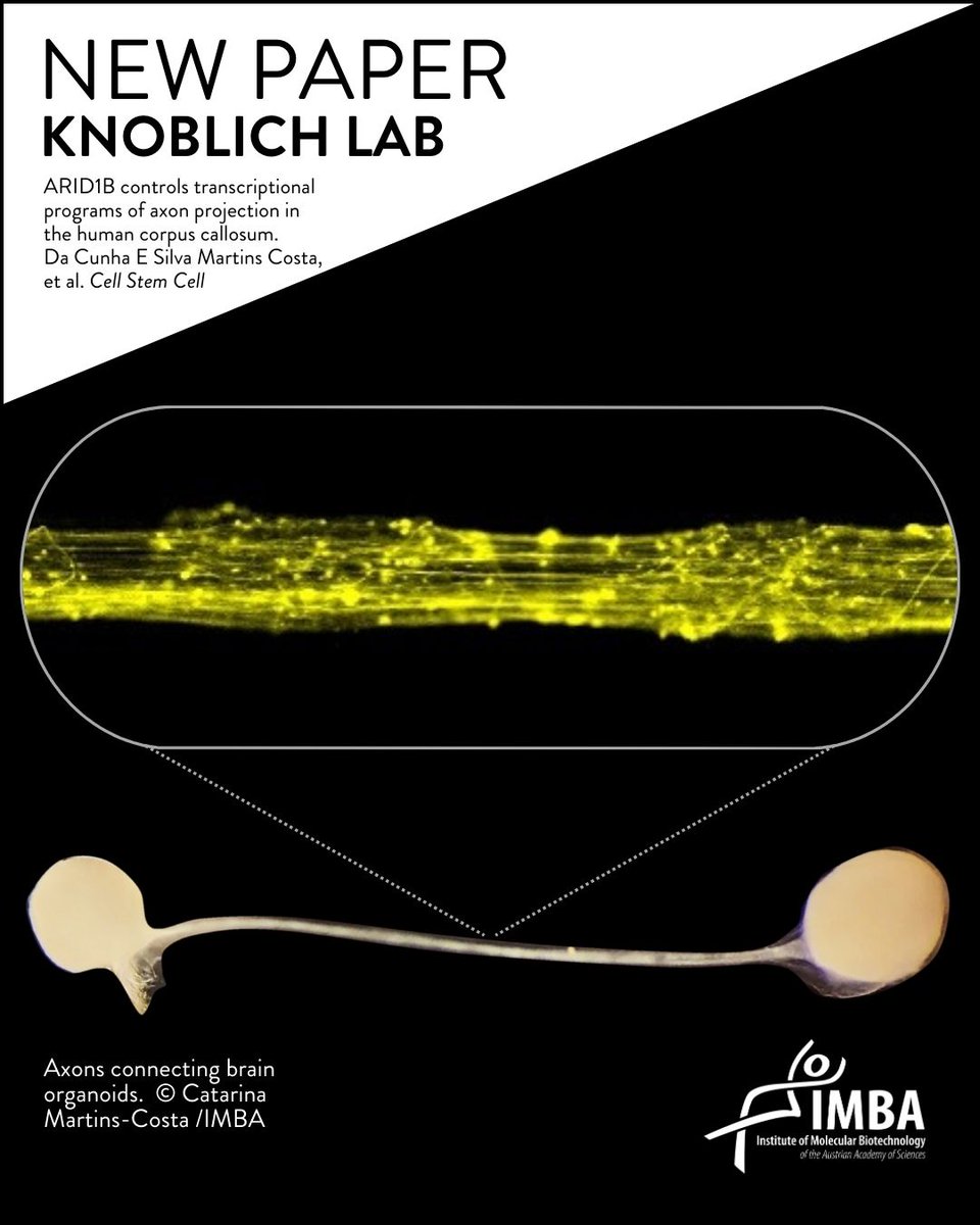 New publication! The group of Jürgen Knoblich reports the development of the first model to study the brain’s information highways. The research, with PhD Student @catarinacsmc as first author, was published today on Cell Stem Cell. More info: bit.ly/3WrXt5u