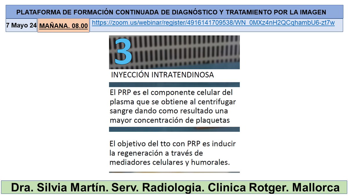 Interesante sesión de la Dra Silvia Martín sobre “Avances en intervencionismo Osteomuscular. Tendones PRP con moderación del Dr Juan Carlos Soler @hospitalclinic @DraSilviaMartin @JoseLuisdelCura @MskSerme @SERVEISoc @idibgi @htrueta @gencat @Radiolegs_CAT @seram_rx @myESR @RSNA