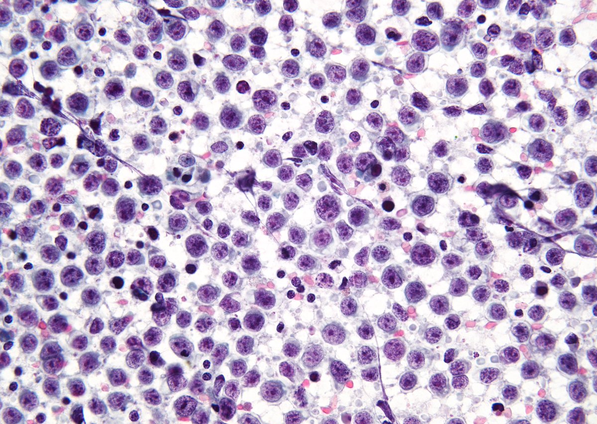 Syed Z. Ali tweet media