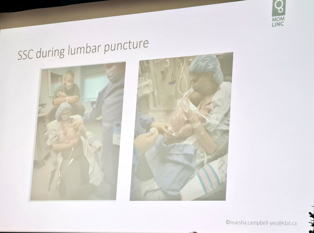 Day 2 at @COINNurses. I'm blown away by the innovative practices delivered by neonatal units World wide! Sweden offering skin-to-skin during procedures. #FICare #Bonding #Autonomy
