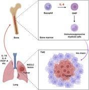 Extra! Extra! Read all about the potential for a novel superior cancer immunotherapy targeting the tumor microenvironment in this #JLB article by Tanaka buff.ly/4ac7E1c