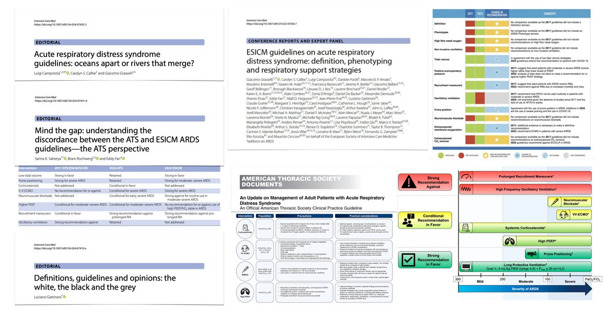 Updated #ARDS guidelines @ESICM vs @atscommunity?🪡🧵 1/4 🌊Both reached overwhelmingly similar conclusions. emphasizing challenges in issuing recommendations that apply to all + importance of individualising care for #ECMO, higher PEEP strategies, NMBAs 🔓rdcu.be/dHb9X