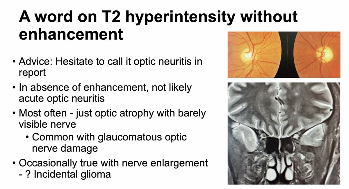 'T2 hyperintensity without enhancement' ASHNR-ESHNR Joint Webinar #HNRadClinical: Ophthalmology by Janet Rucker; moderators: @gmoonis & @TeresaN1977
