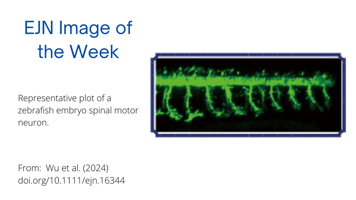 Check out the latest installment in our Image of the Week series! From: doi.org/10.1111/ejn.16… @FENSorg @WileyNeuro @FudanUniv