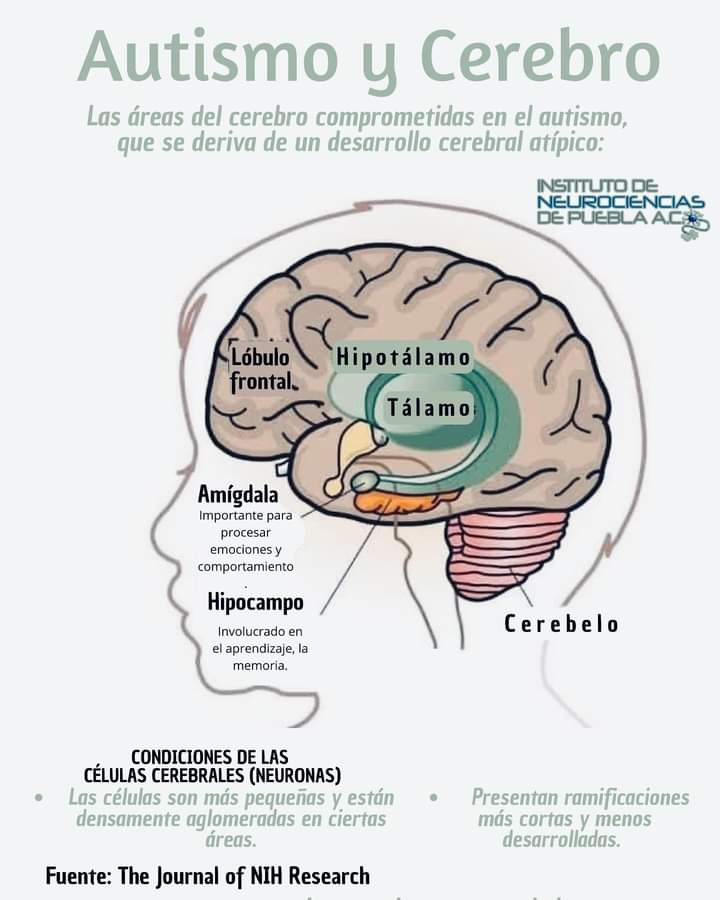 Autismo y cerebro 👇👇👇👇👇