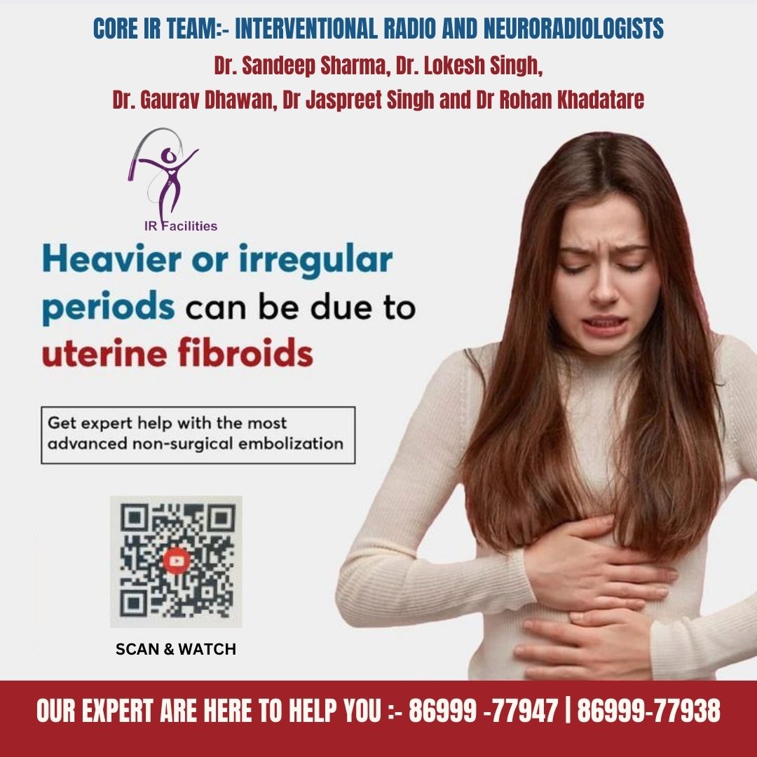 Fibroids can stimulate the growth of blood vessels, which may cause spotting between periods and heavy or irregular periods. Talk to our experts now to know more! Book an Appointment with Dr. Sandeep Sharma at +91 86999-77947
.
#IRFACILITIES #UterineFibroids