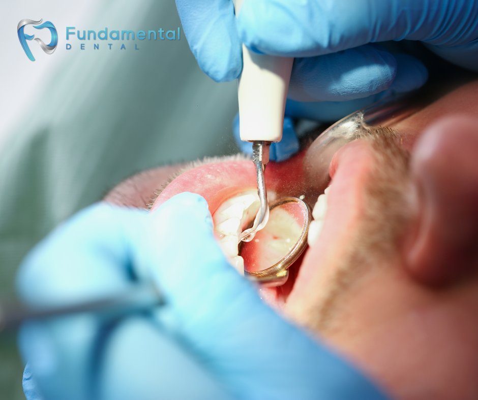Experiencing tooth pain and looking to get it checked out? Call us for an appointment, and we'll get to the bottom of your toothache! 

#FundamentalDental #FunDental #Dentist #Dental #DentistOffice #DentalTreatments #OralHygiene #RootCanals #Crowns #Bridges #Pediatric #DallasTX