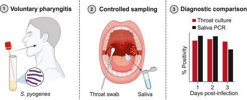 💧The spit is it!💧@Anuk_Indra @DrmartinaS @uowresearch led a cool project with @GeneticSig to use ‘3base’ tech to develop a #StrepA test 🧪 for SALIVA 💧more sensitive than throat swab culture 🧫. Nice validation with human challenge samples. doi.org/10.1016/j.tala…