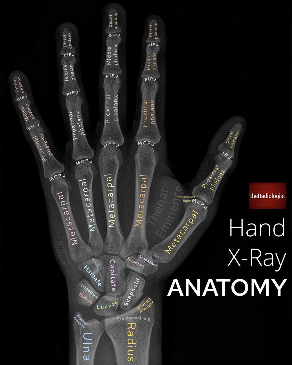 Hand X-Ray anatomy
