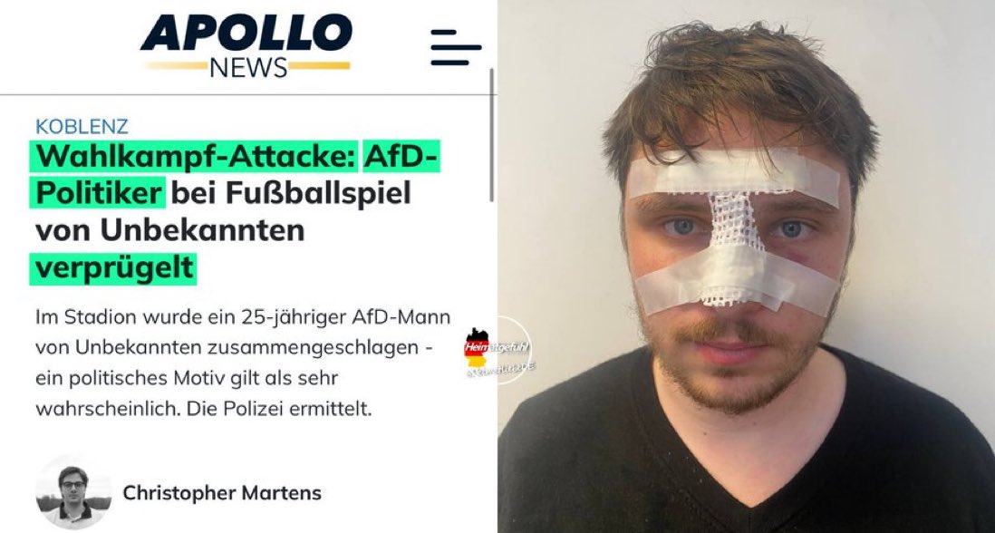 This is Robert. An AfD campaigner from Koblenz, Germany. Robert was attacker and beaten by unknown people. He suffered a broken nose. AfD politicians are being targeted in a politically motivated attacks. Where is the outcry from the media and politicians now?