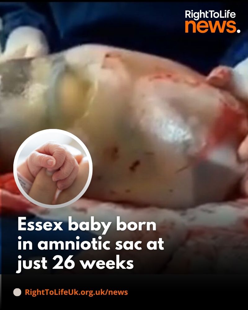 Six medical professionals were given commendations after their “exemplary” response to an emergency where a 26-week-old baby was born in his amniotic sac👏 To read the full article, click here: righttolife.org.uk/fj9u