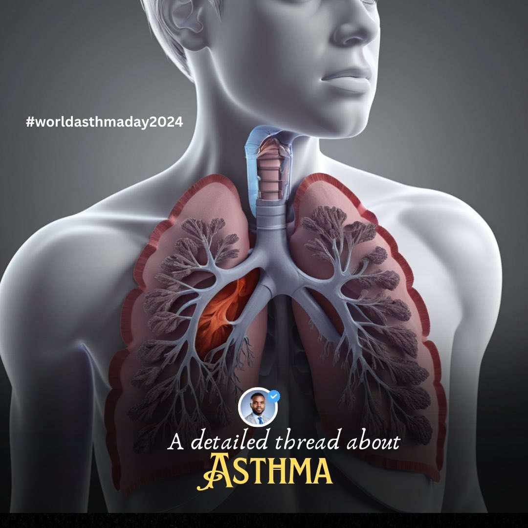 Asthma is a chronic respiratory condition that affects millions globally. 

It involves inflammation and narrowing of the airways, causing breathing difficulties. 

Keep reading to learn what asthma is and how it impacts lives.
#WorldAsthmaDay2024 

👍🏼 bookmark and share