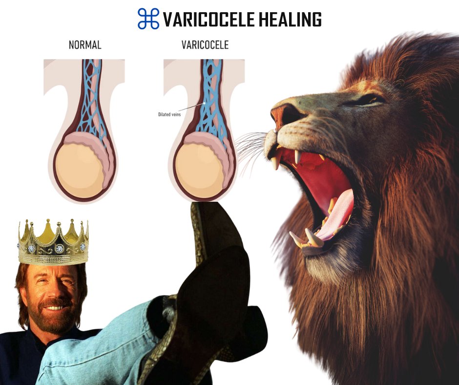 Stud Briefs: Vanishing varicocele like a beast unleashed – poof! Abracadabra, and your 'boys' are now war-ready, like a Viking horde charging into battle. ⚔️🛡️
www,studbriefs.com
#studbriefs #menunderwear