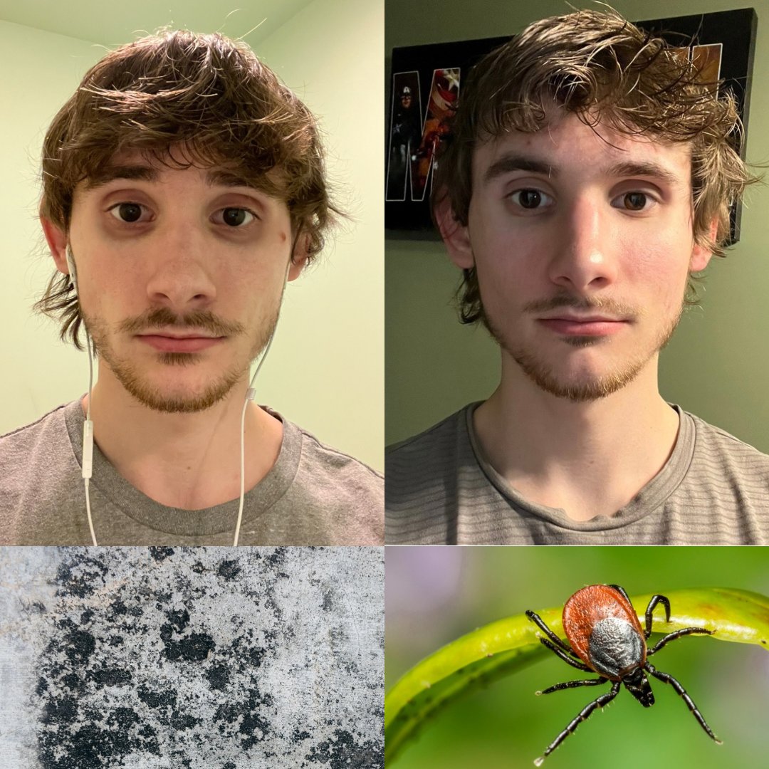 5 years of battling health issues.

Crazy symptoms that would fluctuate but the big 3 were:

- IBS
- Chronic fatigue
- Absurd mucus and congestion

Doctors had no idea what my problem was but kept pushing drugs.