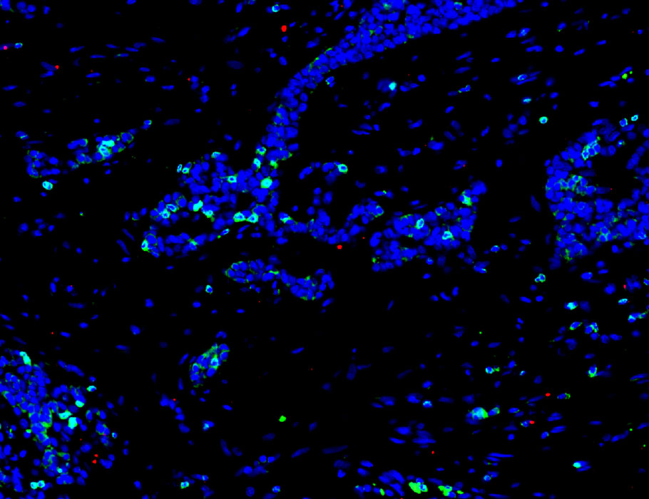 Science Immunology (@sciimmunology) on Twitter photo A natural killer ligand on activated #Tcells could be a new checkpoint to target in multiple #immune diseases and #cancer, according to new research. <a href="/broadinstitute/">Broad Institute</a> <a href="/Platten_lab/">The Platten Lab</a> <a href="/DKFZ/">DKFZ</a>
📄: scim.ag/6S5 A natural killer ligand on activated #Tcells could be a new checkpoint to target in multiple #immune diseases and #cancer, according to new research. <a href="/broadinstitute/">Broad Institute</a> <a href="/Platten_lab/">The Platten Lab</a> <a href="/DKFZ/">DKFZ</a>
📄: scim.ag/6S5