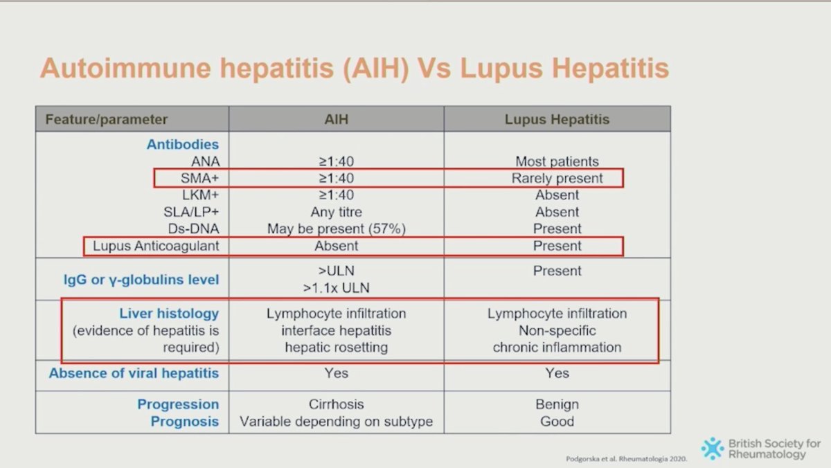 Autoimmune #Hepatitis (AIH) vs #Lupus Hepatitis 

Can be tricky to tease out the differences between the 2 conditions both can be ANA+ etc

Histology essential to clinch diagnosis ‘Interface hepatitis’ or ‘Hepatic rosetting’ is pathognomonic of AIH 

(Dr Amera Elzubeir)

#BSR24