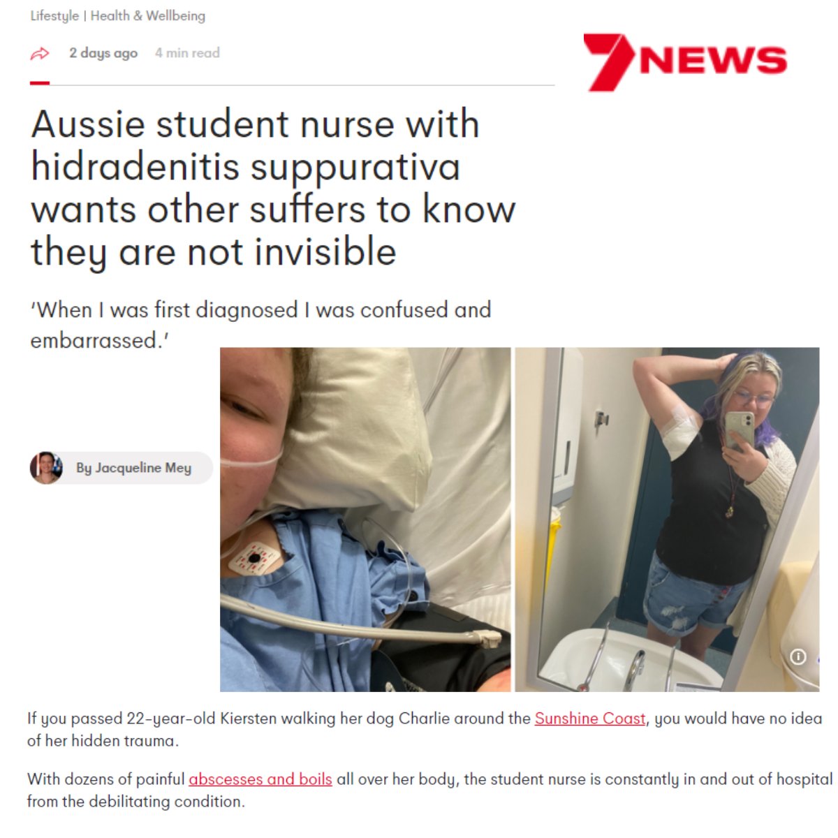 This 'Aussie student nurse with hidradenitis suppurativa wants other suffers to know they are not invisible' and we love her for it!

Read in full> see linktr.ee/HidraWear 

#hidradenitissuppurativa #dermtwitter #medtwitter #dermatology