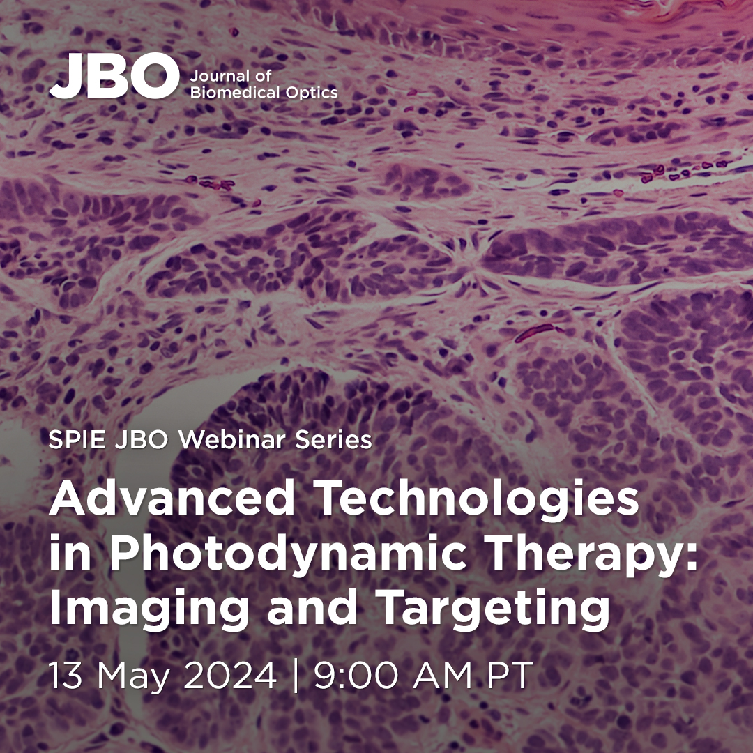 Hear from Alberto Ruiz (@QUEL_Imaging), Srivalleesha Mallidi (@valli_mallidi), and @GirgisObaid (@Lab_Obaid_UTD) in this upcoming #SPIE_JBO webinar on 13 May! They will discuss latest advancements in #photodynamic therapy. Register here: spie-org.zoom.us/webinar/regist… @BrianPogue19