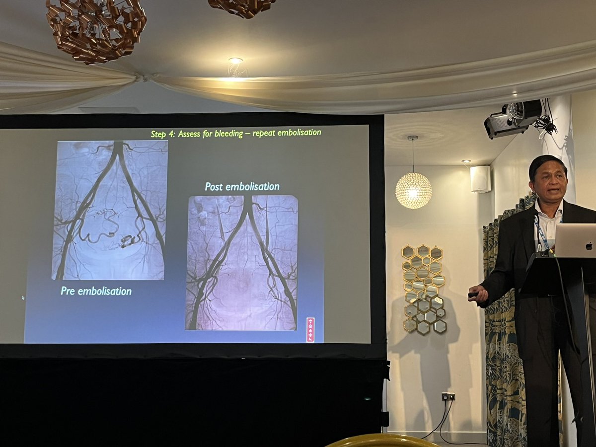 @dramjones @ObsAnaes @DOckendenLtd @OckReview Interventional Radiology access can be life saving in PPH 🩸. Dr Raghuram Laxminarayan, Consultant Interventional Radiologist takes us through the incredible techniques used in our obstetric patients 🤰 @ObsAnaes #obsanaes #ysoa