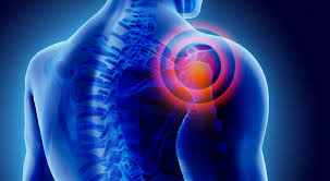 SYMPTOMS OF A ROTATOR CUFF INJURY?
The most common presentation is pain in the shoulder which comes on suddenly or gradually over time, the pain can be felt in various locations around the shoulder or down into the upper arm. 
For treatment please contact the clinic 01298 214994
