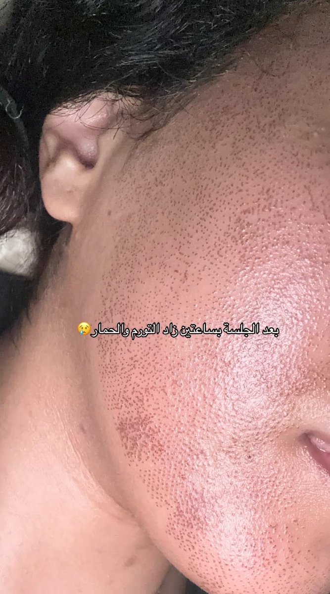 مَيساء | Miysa tweet media