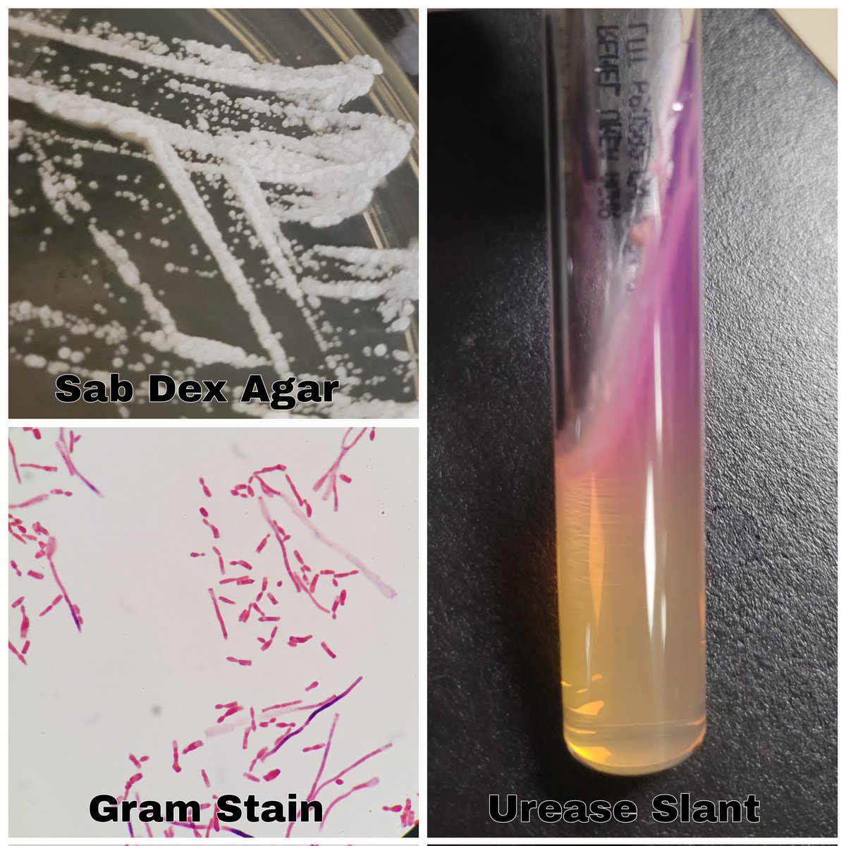 ⚪️ Brittle white colonies ✅️ Urease positive 🧫 Arthroconidia and budding yeast seen in colony Gram Stain Who am I?