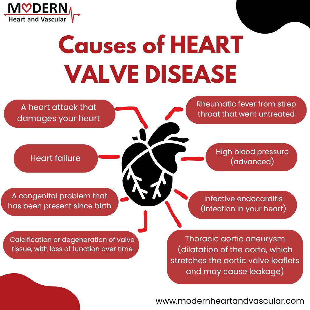 The heart's four chambers (2 ventricles, 2 atria) rely on valves for unidirectional blood flow. These valves prevent backflow & ensure efficient pumping. Various heart valve diseases can affect one or more valves. Here are some causes of this disease.  #heartvalvedisease