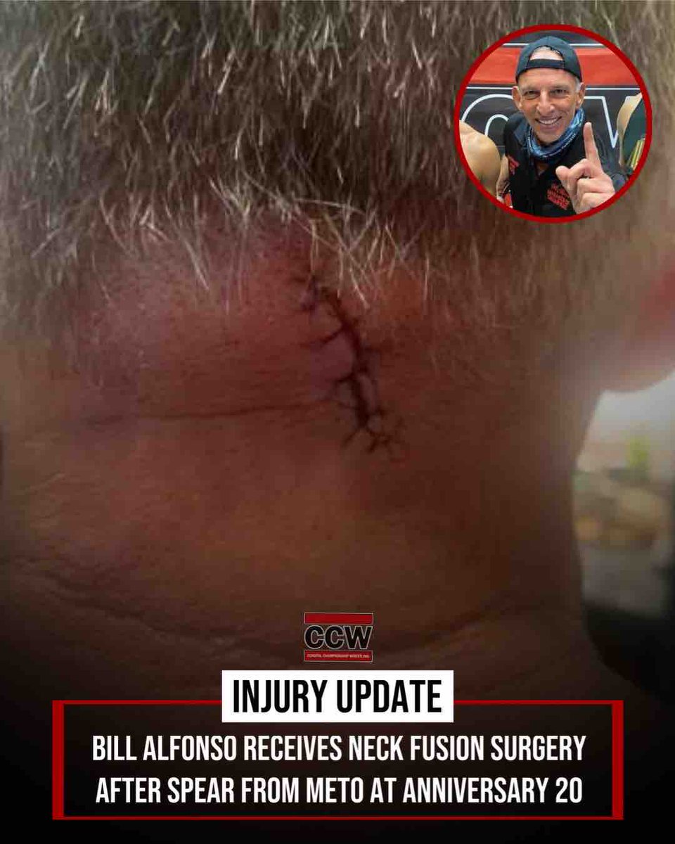 BREAKING: @AlfonsoBill successfully underwent neck fusion surgery after he was speared by Meto at Anniversary. We wish Fonzie a speedy recovery, and hope to see him back soon! This Saturday at BASH 40, @ViniciousFights wants revenge on @MetoBUL. 🎟️🔗: ow.ly/3K1A50Rrujz