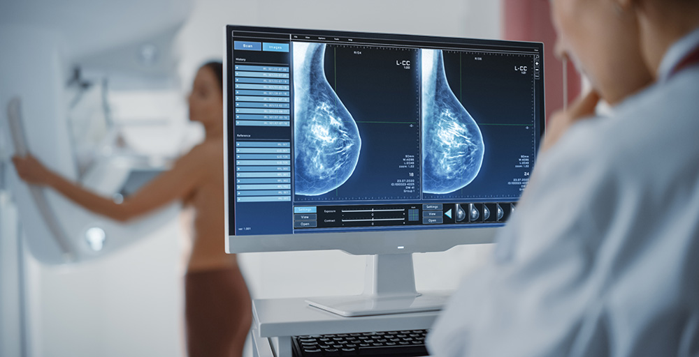 ▶️ Breaking: @USPSTF now recommends mammograms every OTHER year for women age 40 to 72 - and age lowered from 50 to 40. Read more here:  bit.ly/3UtzSz0 #BCSM