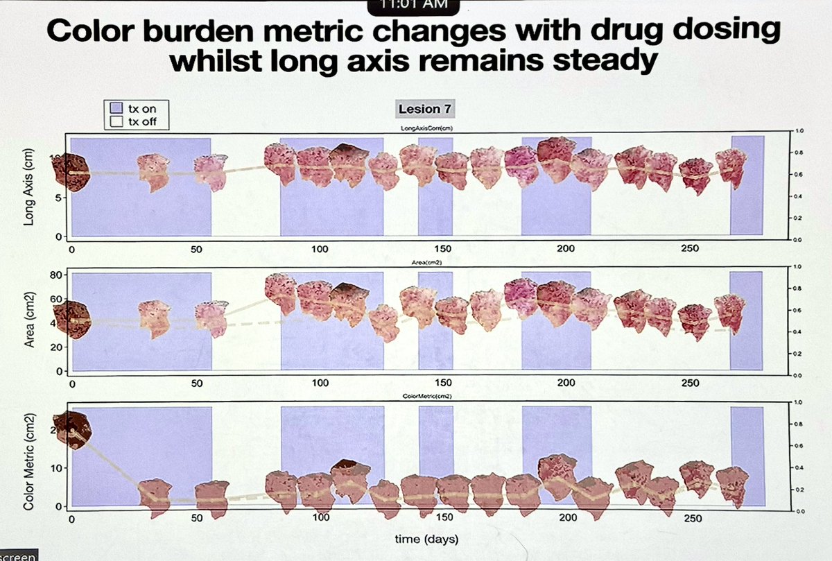 Sandy Anderson (@ara_anderson) on Twitter photo Todays <a href="/mathonco/">IMO</a> research in progress is from #AndersonLab veteran and creative guru <a href="/jillagal/">Jill Gallaher</a> presenting new results from our on going <a href="/EvolTherapy/">Centre for Evolutionary Therapy</a> trial: Developing a data to decision support pipeline for advanced basal cell carcinoma adaptive therapy. Todays <a href="/mathonco/">IMO</a> research in progress is from #AndersonLab veteran and creative guru <a href="/jillagal/">Jill Gallaher</a> presenting new results from our on going <a href="/EvolTherapy/">Centre for Evolutionary Therapy</a> trial: Developing a data to decision support pipeline for advanced basal cell carcinoma adaptive therapy.