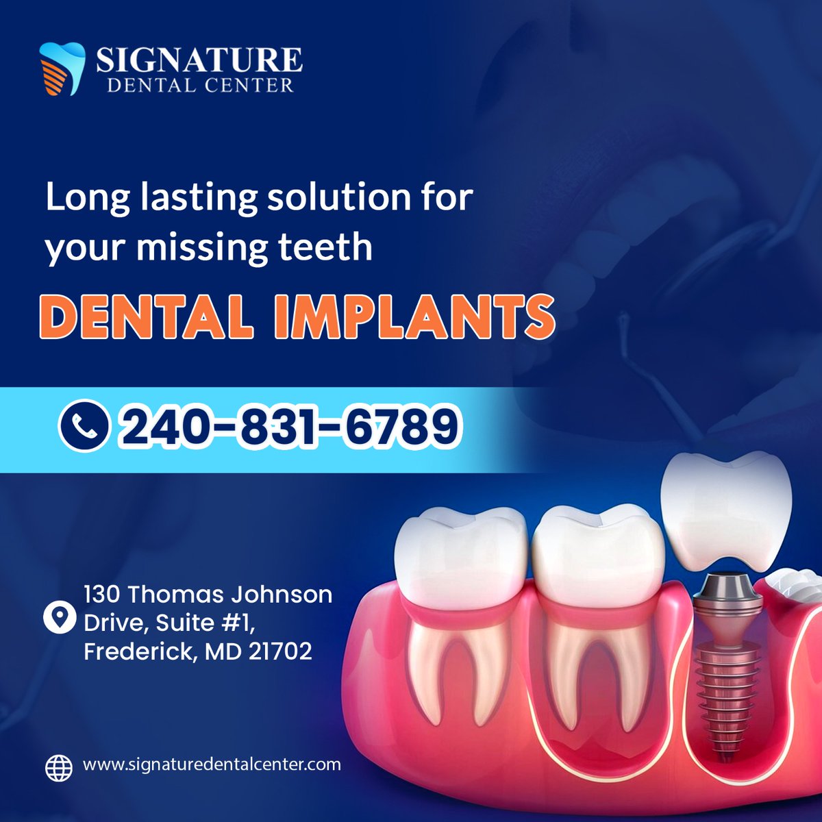 Regain confidence in your smile with dental implants! Say goodbye to gaps and hello to a natural-looking, long-lasting solution.
.
For appointments, call or text: +1240-831-6789
Or Visit: signaturedentalcenter.com
.
#Dentalimplants #Dentaltreatment #toothextraction
#teethwhitening