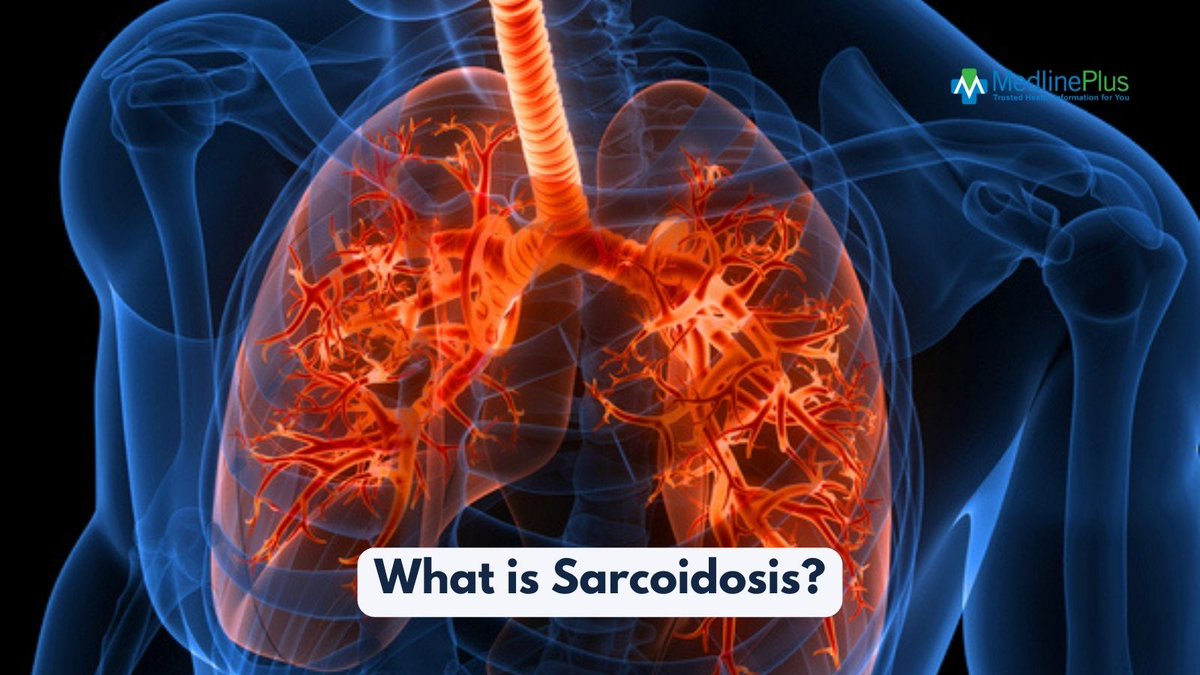 Who is more likely to develop sarcoidosis? You are more likely to have it if you: ➡️ Are older, especially over 55 y/o ➡️ Live or work near insecticides, mold, or other substances that may cause inflammation ➡️ Have a close relative who has sarcoidosis 👉 ow.ly/Tkrz50RqK79