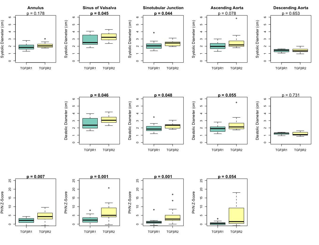 Children with Loeys-Dietz syndrome with TGFBR2 present with more severe cardiovascular phenotypes than those with TGFBR1, requiring genotypes to be considered in clinical management. @lucmertens8 Read more 👉 cjcpc.ca/article/S2772-… #CJCPC