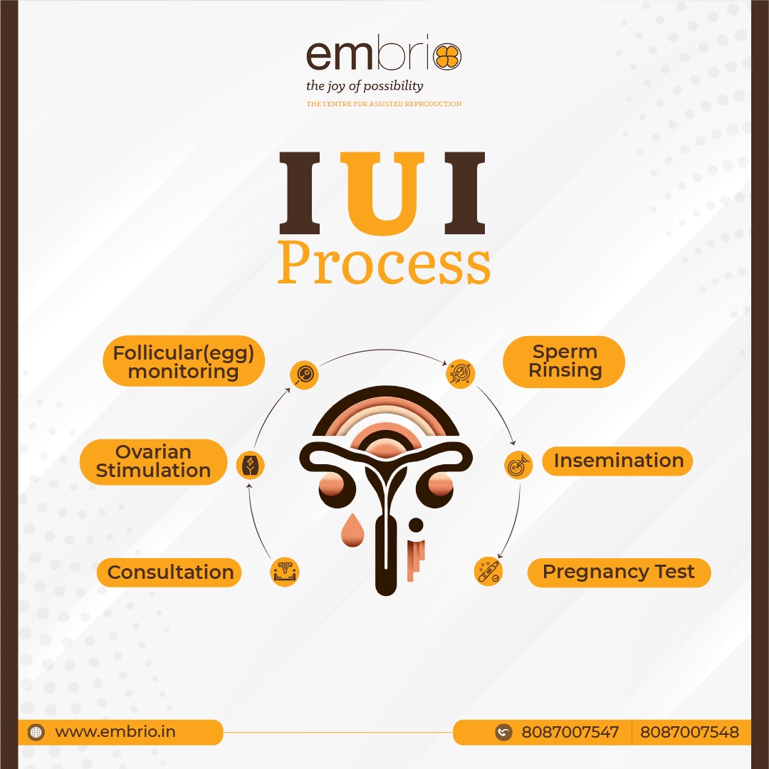 Unveiling the Layers of IUI. Our IUI process offers guidance and support at every step.
Your journey towards parenthood starts here.
#embrioivf #joyofpossibility #IUI #ivftreatment #ParenthoodJourney #PregnancyTest