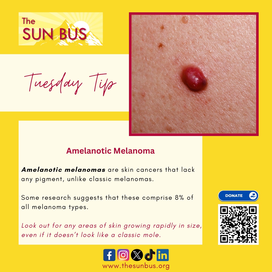 🔍 Tuesday Tip: Amelanotic melanomas are a less common but serious type of skin cancer. Keep an eye out for any rapidly growing skin areas, even if they don't resemble typical moles. Early detection is crucial! #SkinCancerTip #TuesdayTip #TheSunBus 🚨🔍