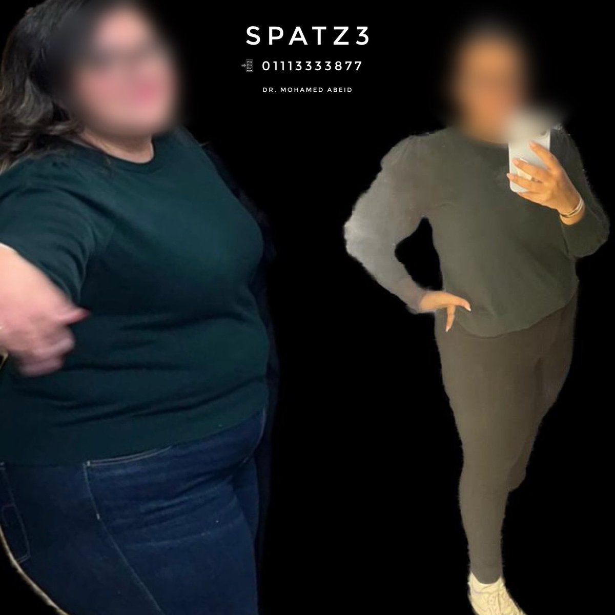 MohamedAbeid's tweet image. #SPATZ3; the best #weightloss solution in 2024!
Without #surgery
Without #drugs