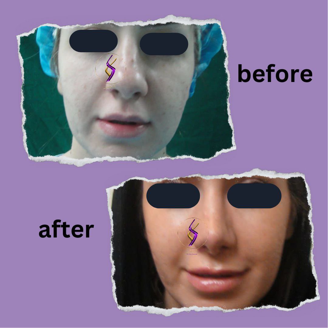 Dr.Sara Ghorbani tweet media