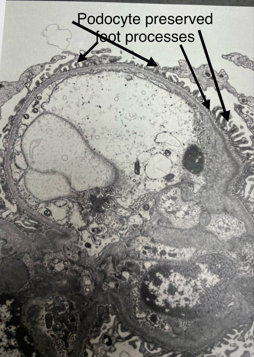 SethiRenalPath tweet picture