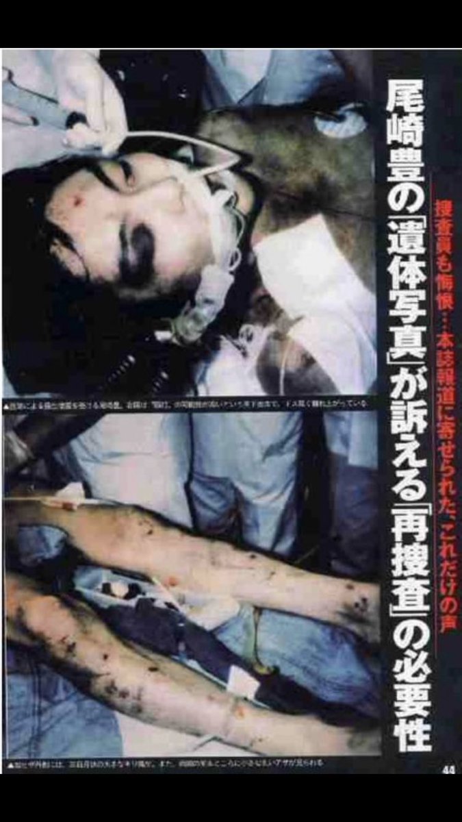 アンテナ tweet media