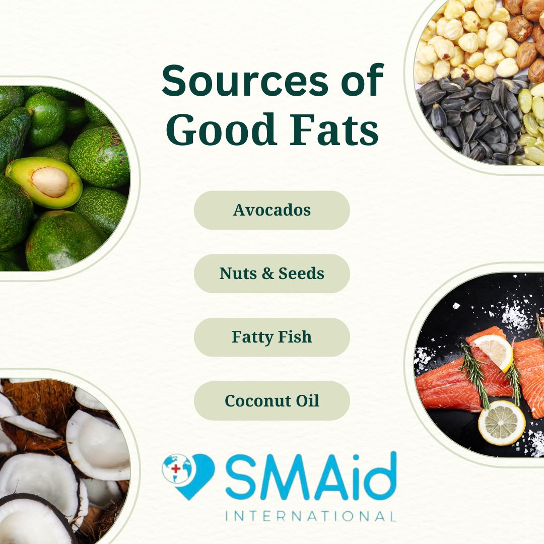Avocados, nuts, seeds, olive oil, and fatty fish are healthy sources of good fats. These provide essential fatty acids that contribute to a healthy heart and a sharp mind.

Stay tuned for more healthy fats tips!

#nutrition #healthyfats #nutritionfacts #tuesday #healthylifestyle