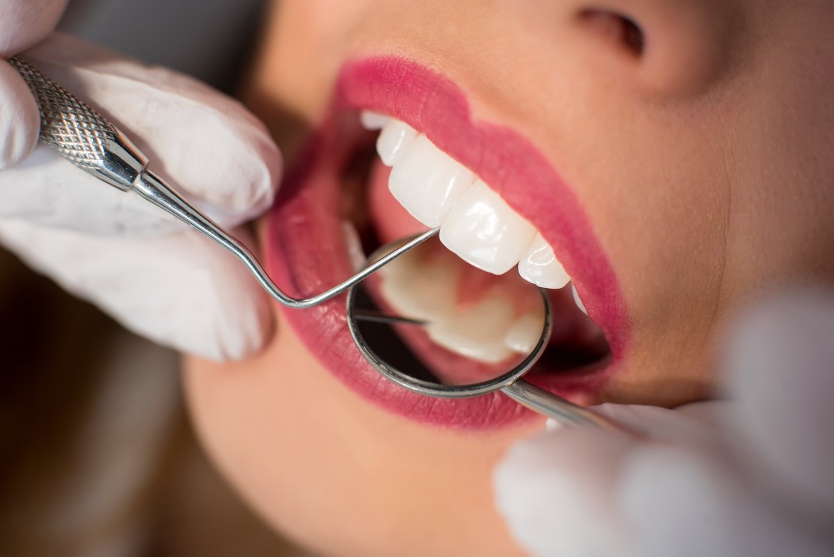 Have you seen what Alameda Aesthetic Dentistry can do for you? Check it out here! williamgardnerdds.com #CosmeticDentistry #CosmeticDentist #Periodontist #RestorativeDentistry #FamilyDentist