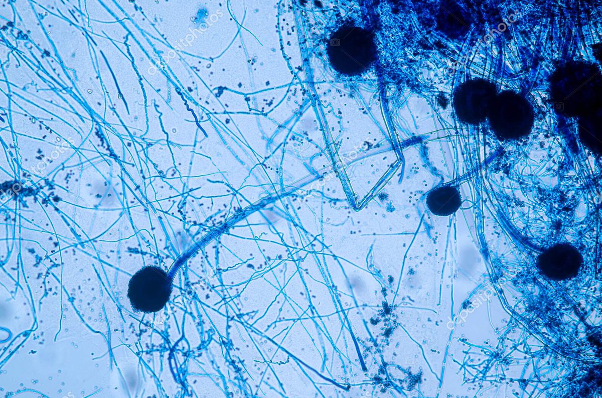 @osterberg_venla En ole asiantuntija, ainoastaan nöyrä alan harrastelija, mutta vaikuttaa joltain nuijahomeelta (Aspergillus). Sanoisin että hakemalla hakusanalla aspergillus niger pääset aika lähelle.