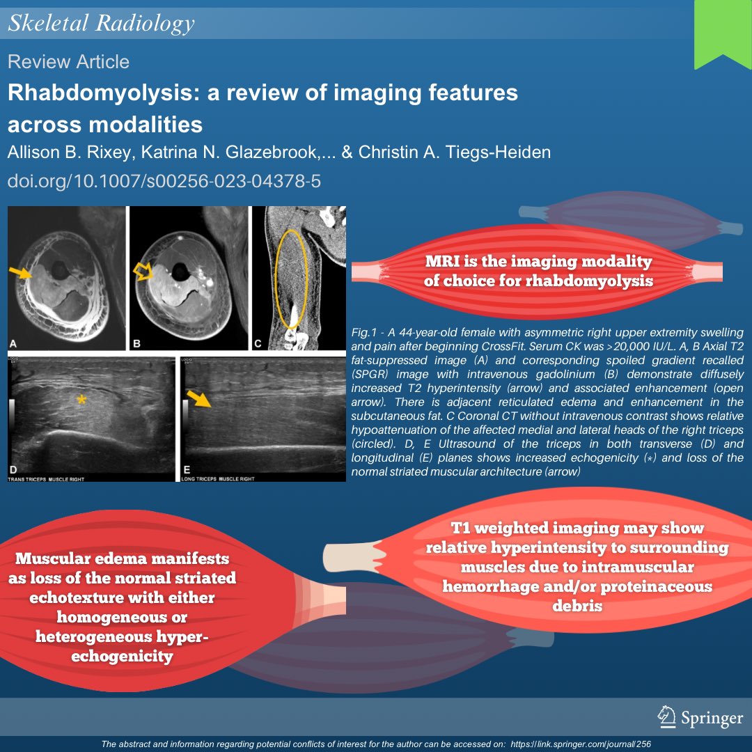 Check out our informative infographic:

🟢 Rhabdomyolysis: a review of imaging features across modalities | rdcu.be/dwgJZ

#SkeletalRadiology #SkeletalJournal #SKRAJournal #MSKrad #orthopedics