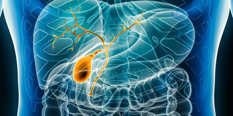 💊 Updated follow-up results from the phase 3 TOPAZ-1 study revealed that #durvalumab with chemotherapy can improve OS in patients with advanced #cholangiocarcinoma.

Learn more about the 3-year follow-up results: buff.ly/3JAnWWP 

#BileDuctCancer