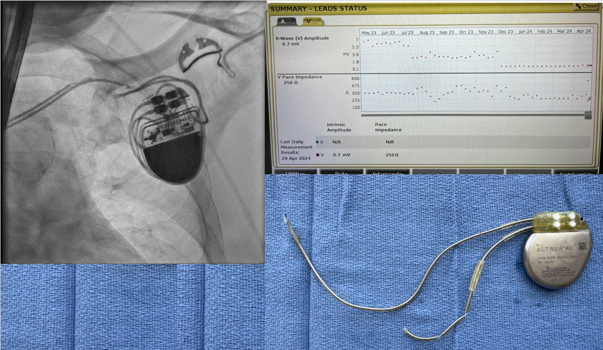 Tom McElderry MD FACC FHRS (@tommcelderry) on Twitter photo  Tom McElderry MD FACC FHRS (@tommcelderry) on Twitter photo