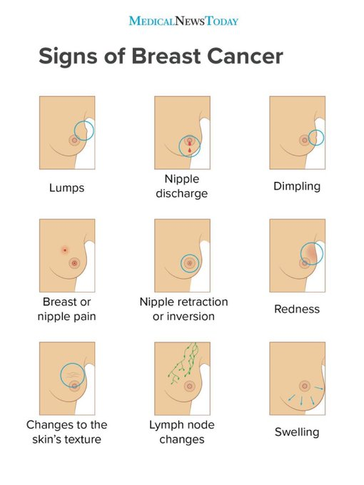 This tweet can never be tweeted enough - 🎗️ EARLY DETECTION IS KEY! 🎗️ Signs of Breast Cancer 🎗️