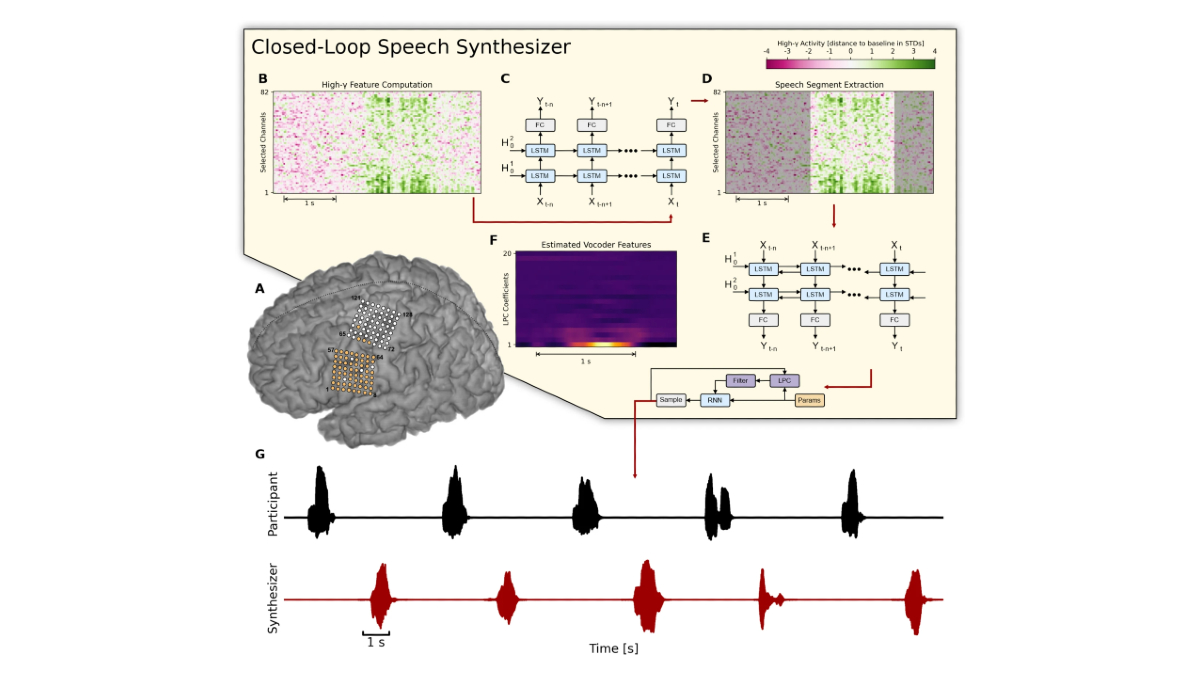 New #research alert! @SciReports has a paper detailing online #SpeechSynthesis using a #brain–computer interface in an individual with #ALS. The study aims to propel additional research into the feasibility of #BCIs for restoring vocal communications: go.nature.com/4aXfHjV