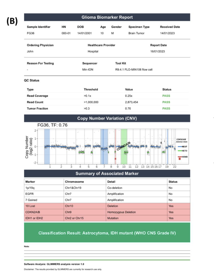 BioinfoAdv's tweet photo. Introducing GLIMMERS: Glioma Molecular Markers Exploration Using Long Read Sequencing! This open-source tool automates CNV analysis for glioma classification & grading from nanopore data. No more manual marker extraction! #Bioinformatics #Glioma #LongReadSeq https://t.co/cj7GsLEa2Q @WichayapatT