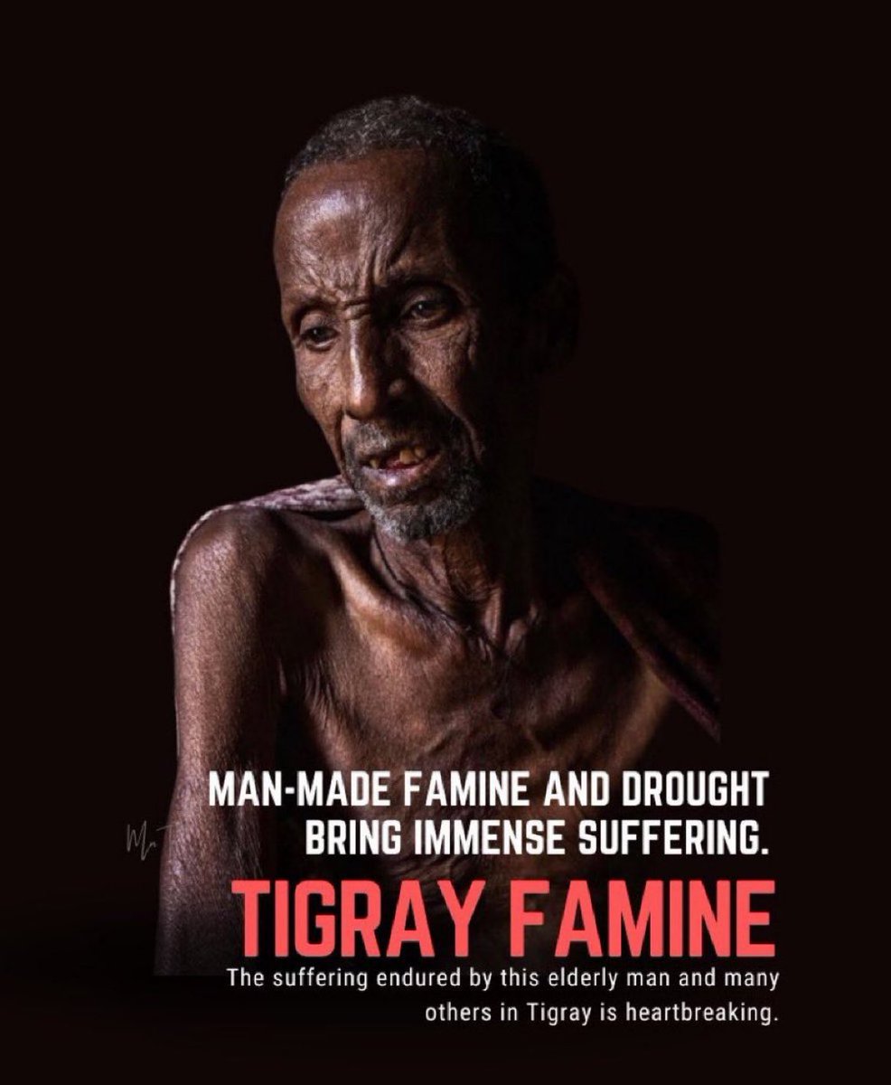 Due to the deliberate destruction of the healthcare system in #Tigray by invading forces plus the humanitarian Blockade, and the man-made #TigrayFamine caused people to die because of hunger! @POTUS @SecBlinken @WFPChief @WFP @bettyvegas3